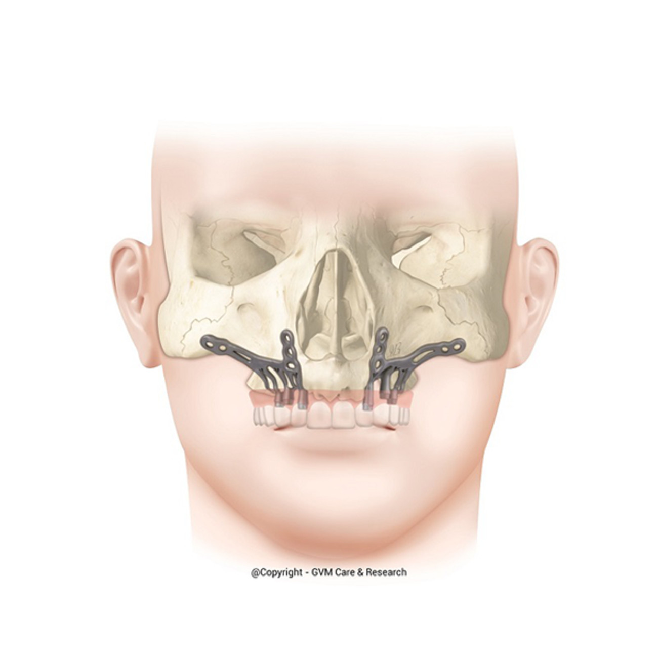 Article about AMSJI on DentalAcademy.it