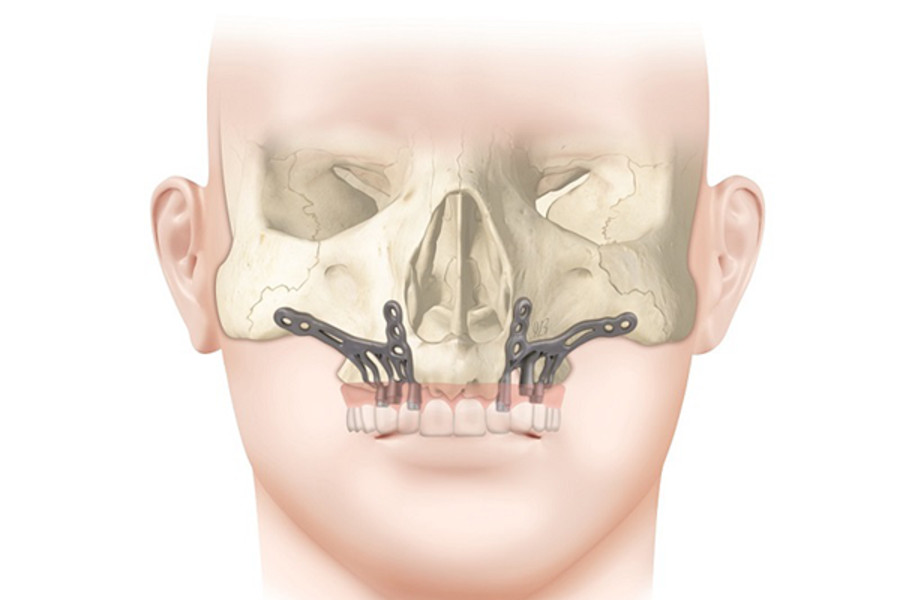 Article about AMSJI on DentalAcademy.it